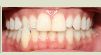 Photo of Camilo Riaño Orthodontics Top Rated Orthodontist In Beautiful San Francisco