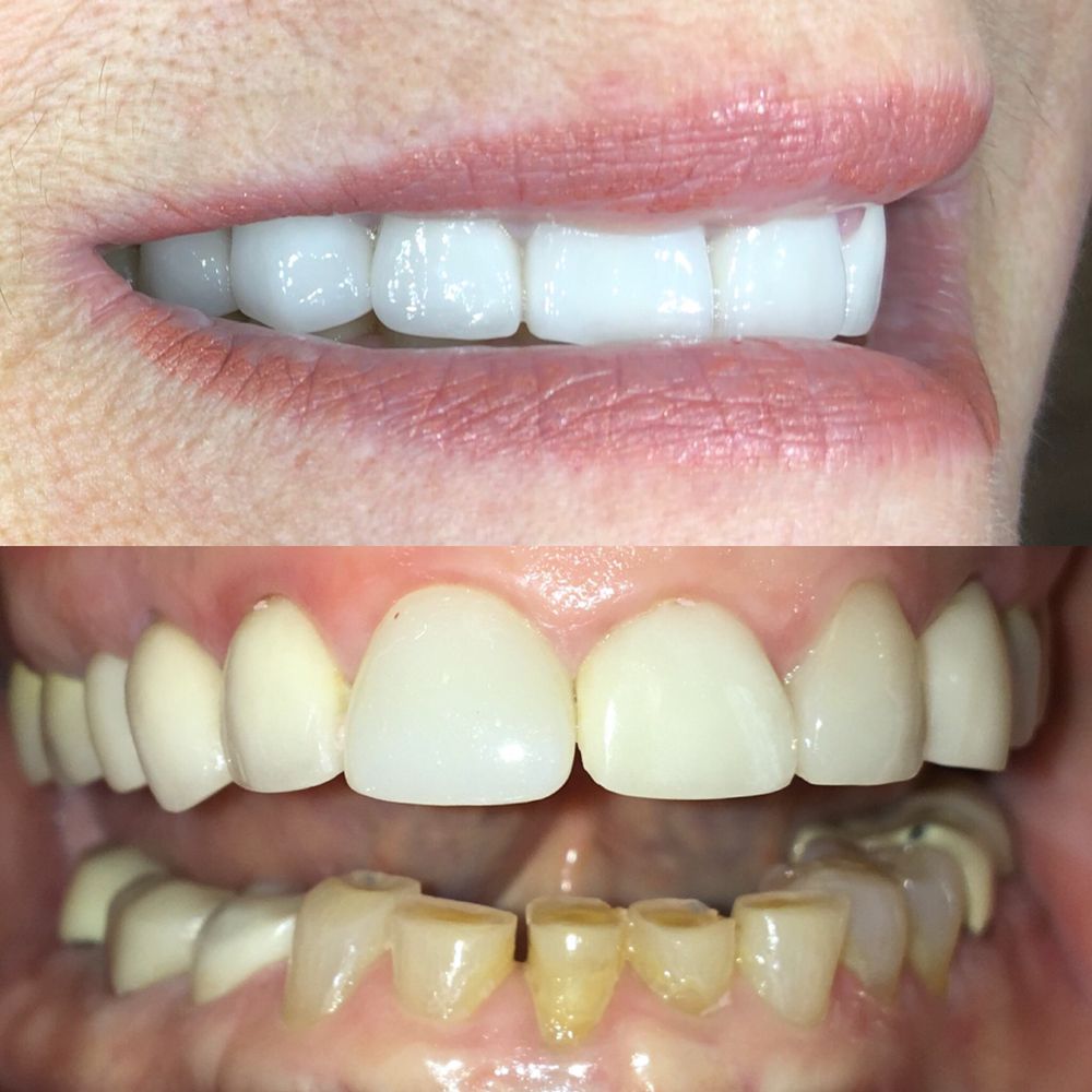Photo of Brian Nitzberg, DMD - Miami Best Dental Quality Porcelain And Other Dental Materials