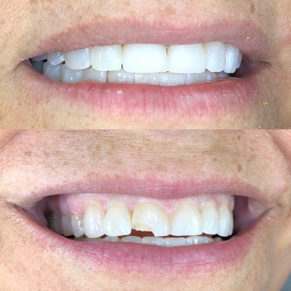 Photo of Brian Nitzberg, DMD - Miami Best Dental Quality Porcelain And Other Dental Materials