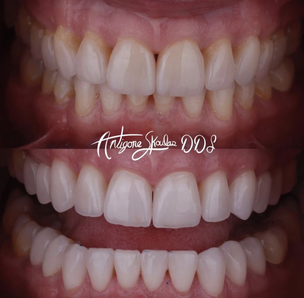 Photo of Antigone Skoulas, DDS Dental Procedures
