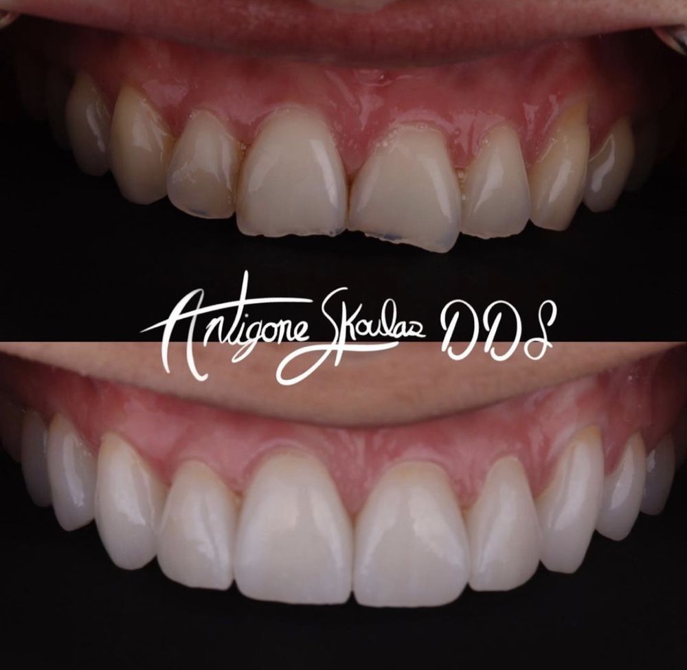 Photo of Antigone Skoulas, DDS Dental Procedures