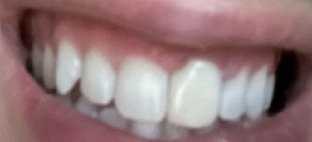 Photo of Dentistry of San Francisco - General & Cosmetic, Dr. Joseph DDS specializes in both General and Cosmetic Dentistry