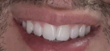 Photo of Dentistry of San Francisco - General & Cosmetic, Dr. Joseph DDS specializes in both General and Cosmetic Dentistry