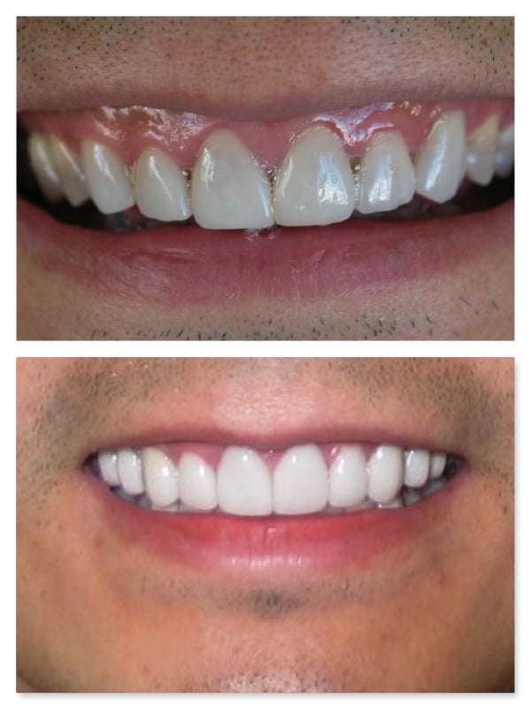 Photo of Richard A Felton, DDS Cosmetic Dentistry