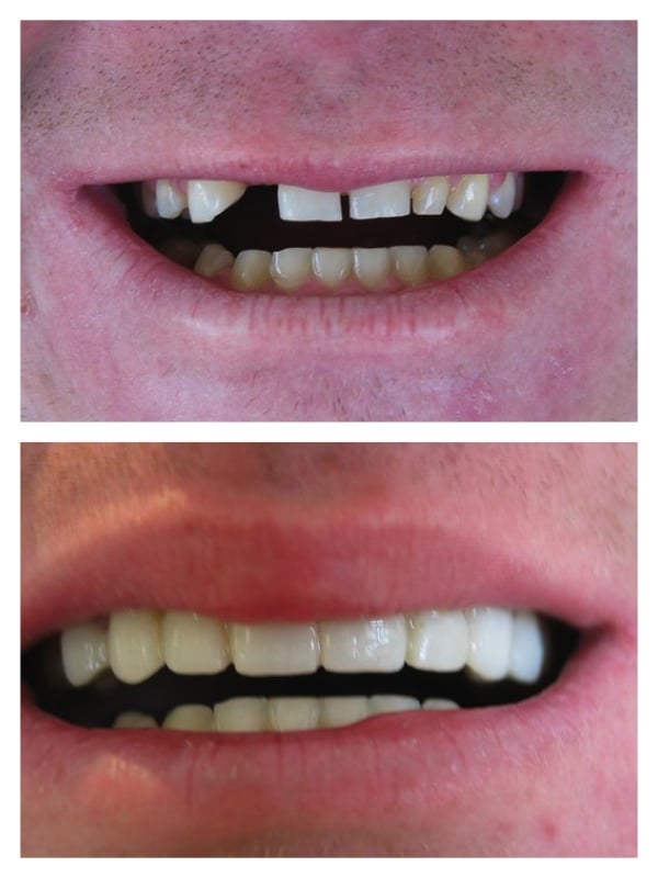 Photo of Richard A Felton, DDS Cosmetic Dentistry