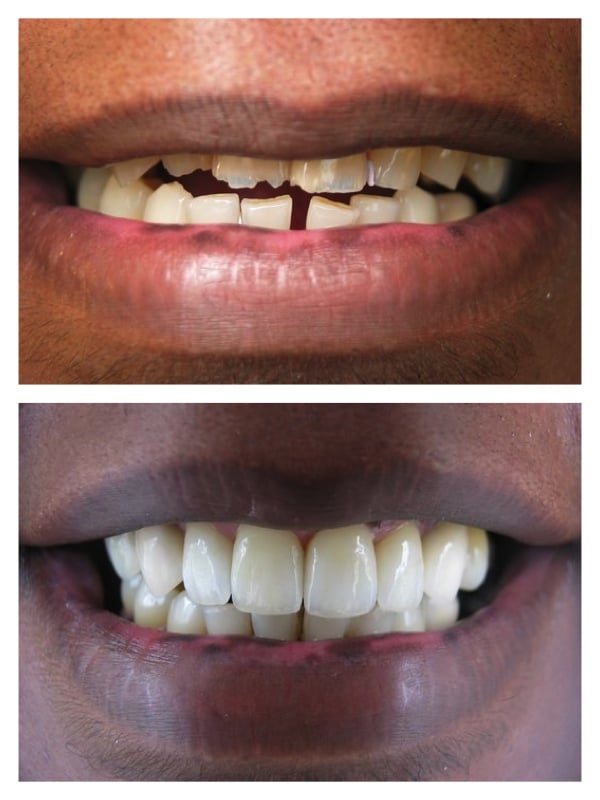 Photo of Richard A Felton, DDS Cosmetic Dentistry