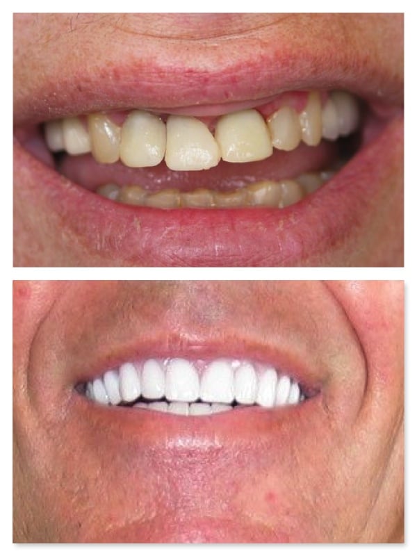 Photo of Richard A Felton, DDS Cosmetic Dentistry