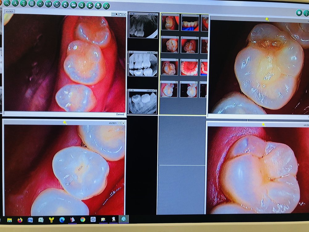 Photo of CitiDent Serve Your Every Dental Need