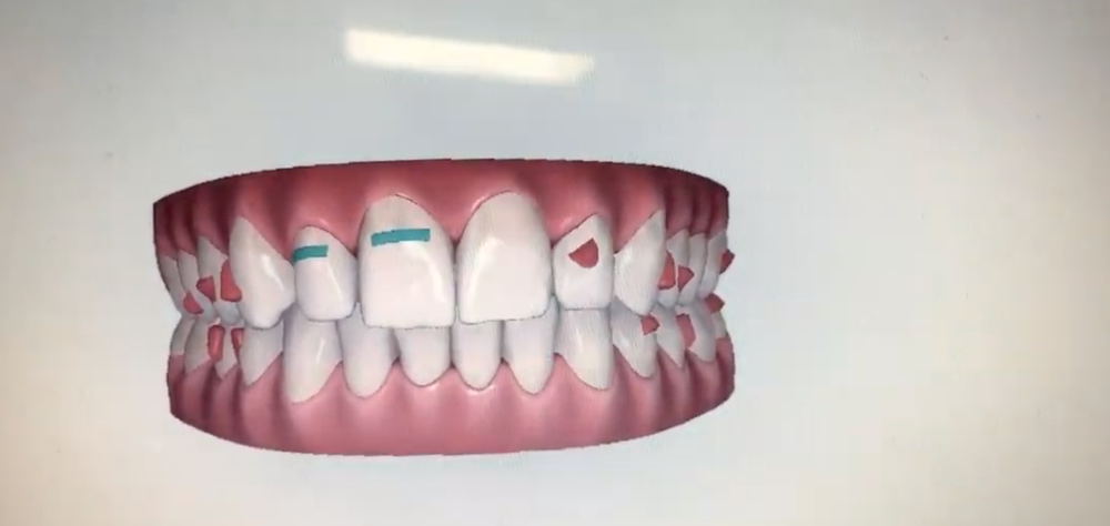 Photo of Russell C Young, DDS - S.F. Star Dental