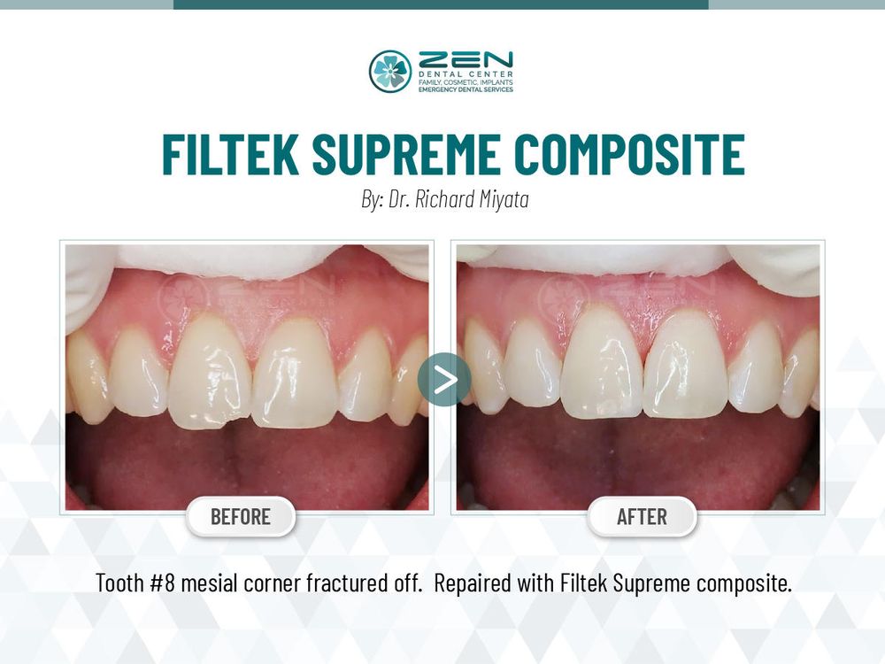 Photo of Zen Dental Center Family Cosmetic Emergency Implants