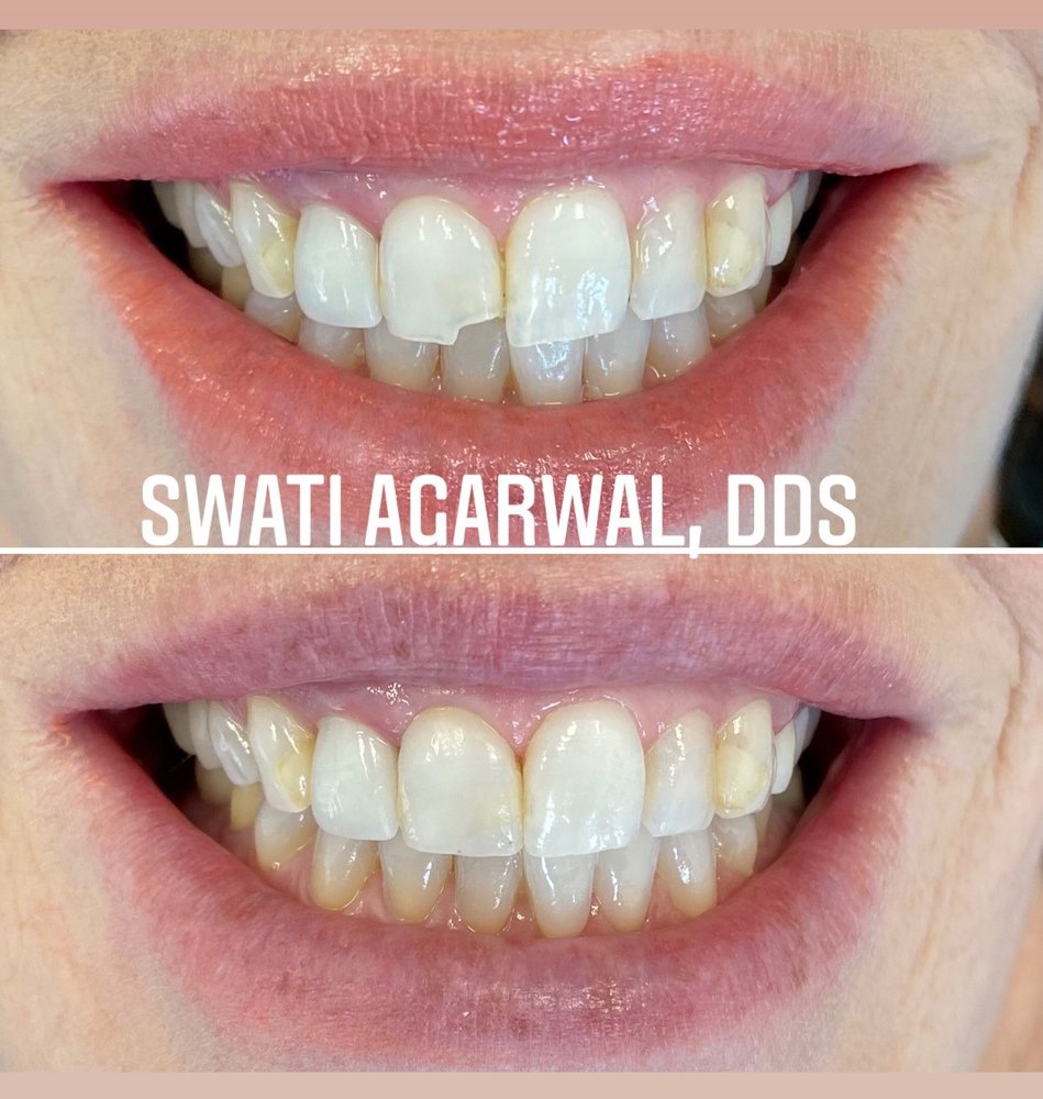 Photo of Swati Agarwal, DDS Team