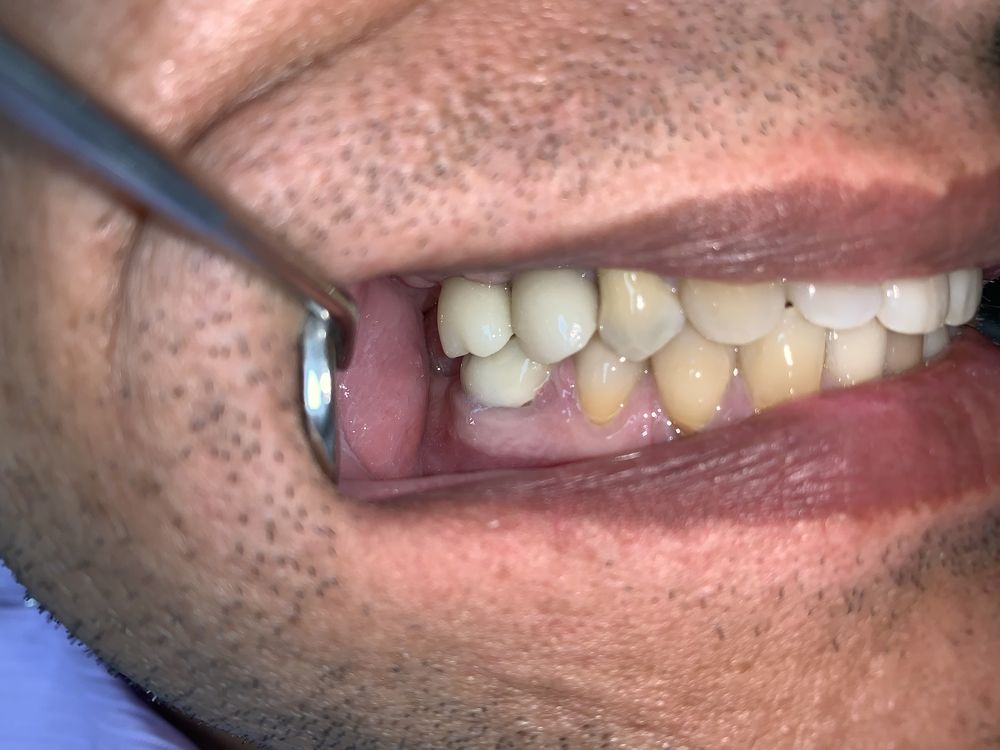 Photo of Cesar Hurtado, DDS Over 20 Years Of Experience In Endodontics