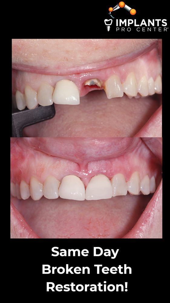 Photo of Implants Pro Center