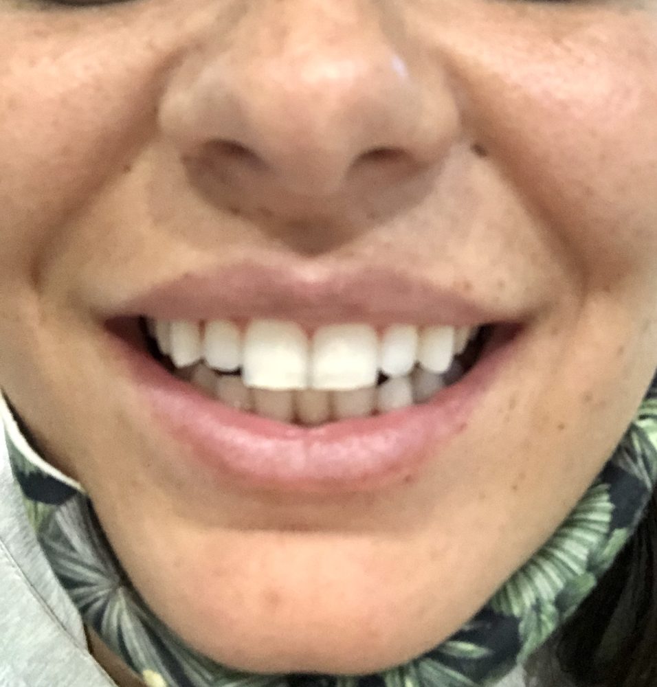 Photo of Fillmore Dental Spa Dental Treatment
