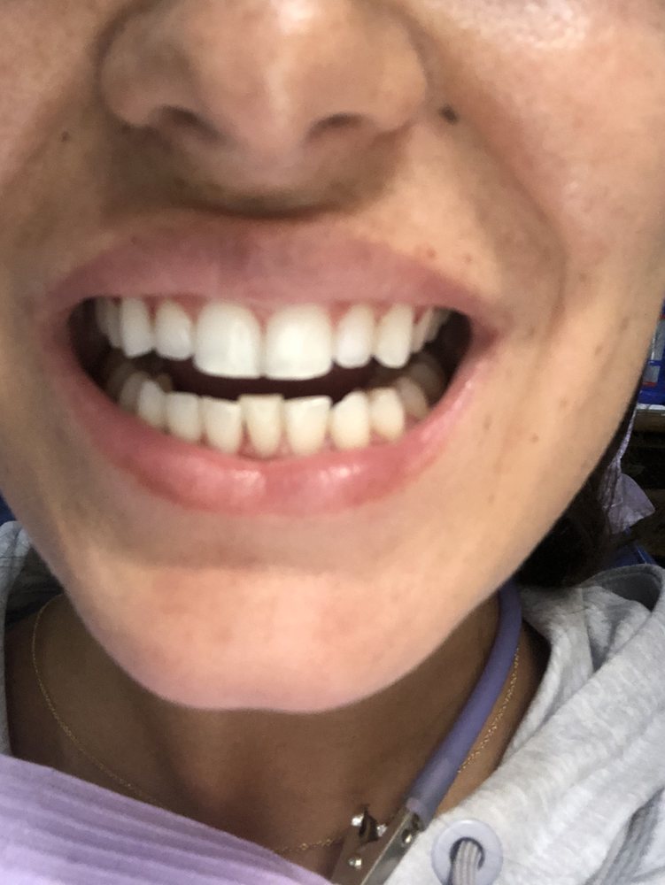 Photo of Fillmore Dental Spa Dental Treatment