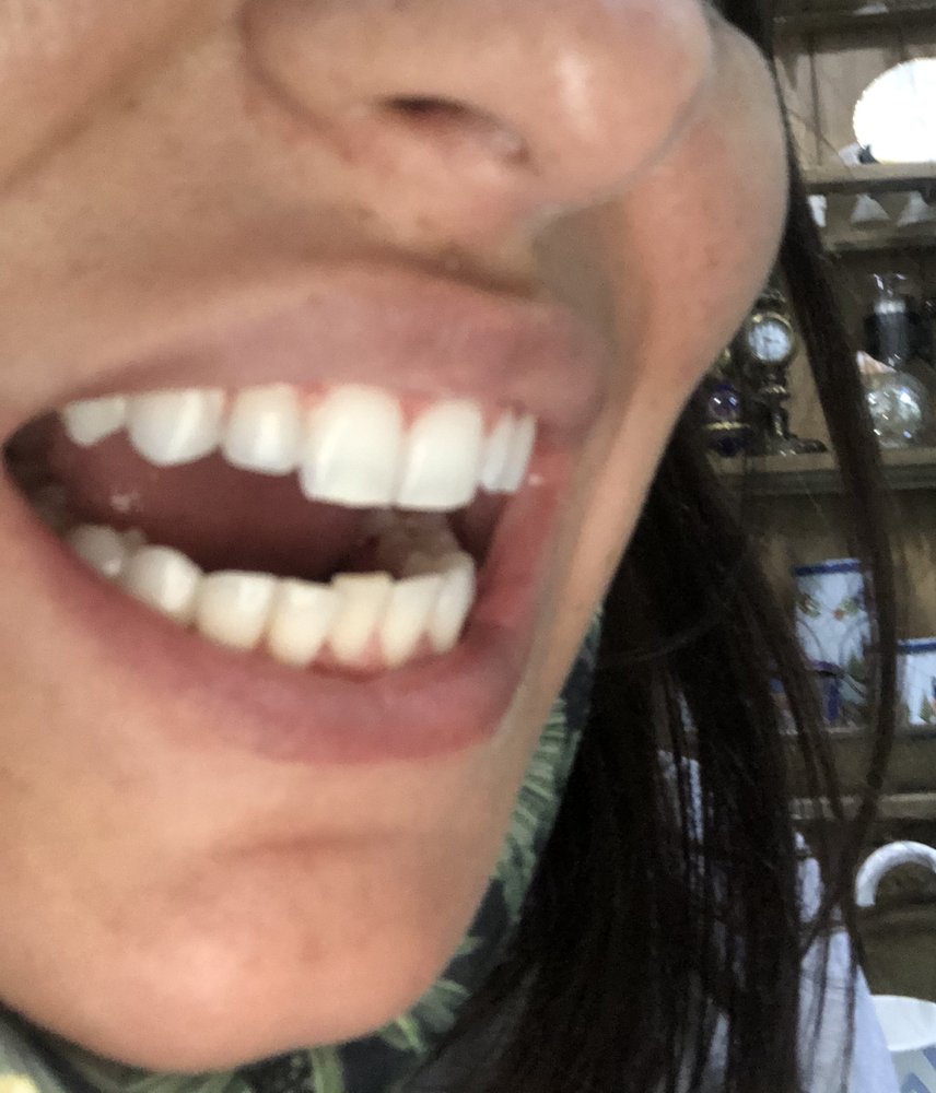 Photo of Fillmore Dental Spa Dental Treatment