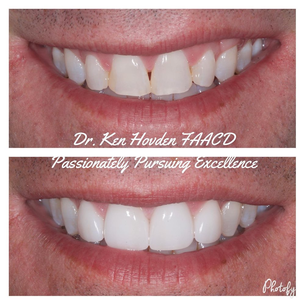 Photo of Kenneth Hovden, DDS Top Quality Dental Services