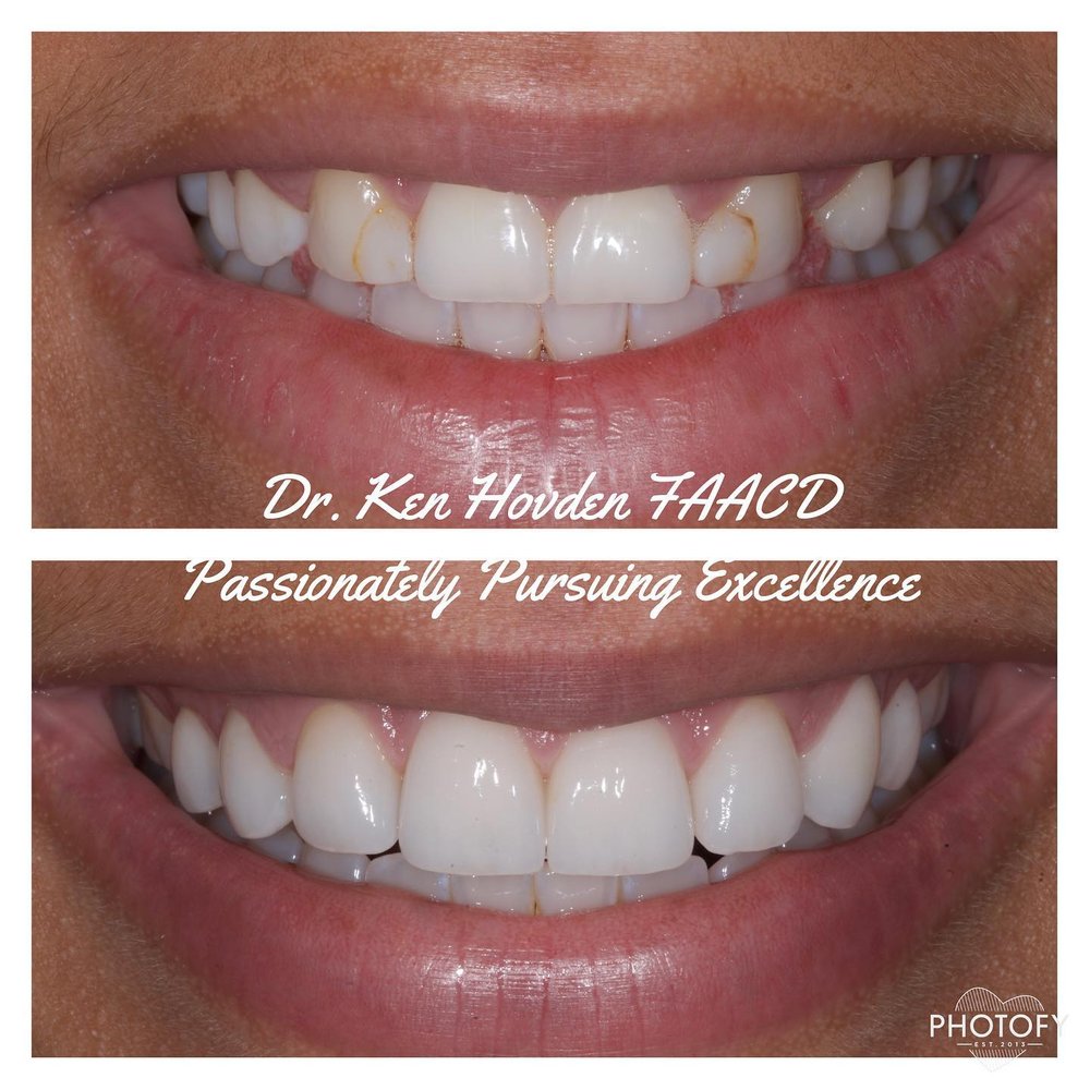 Photo of Kenneth Hovden, DDS Top Quality Dental Services