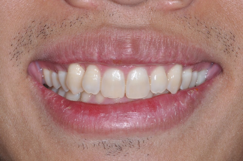 Photo of Carrie Berkovich, DDS MS Streamline Our Patients' Treatment