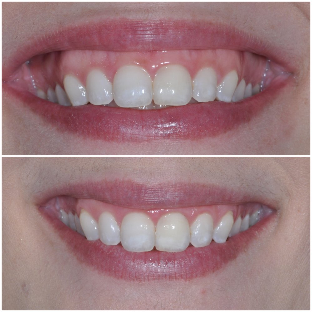 Photo of Carrie Berkovich, DDS MS Streamline Our Patients' Treatment