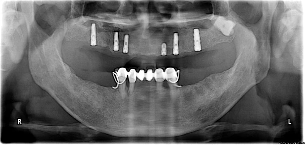 Photo of Dental Implant and Oral Surgery Center