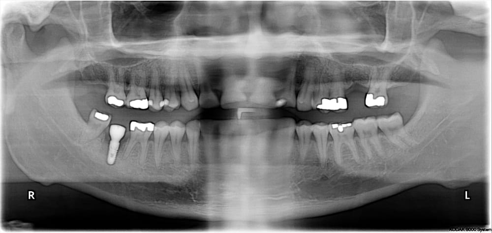 Photo of Dental Implant and Oral Surgery Center