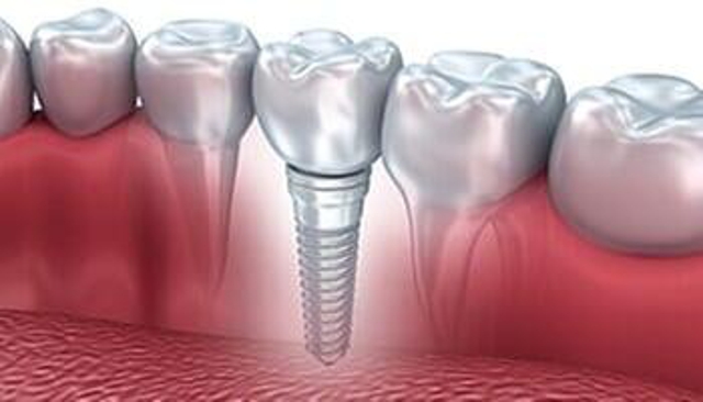Photo of 34th Street Dental Care providing expert dental services