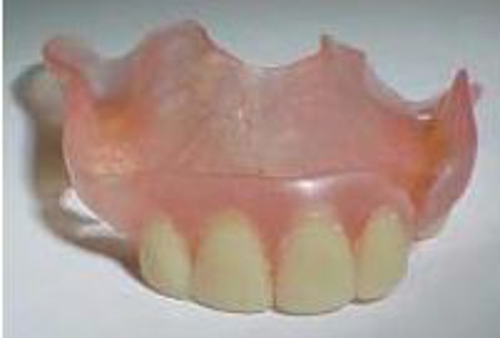 Photo of OMS Center Getting Dental Implants In Lafayette Or Logansport