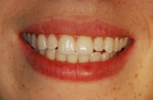 Photo of Marlin Gerald M DMD Providing Dental Implant And Cosmetic Dentistry
