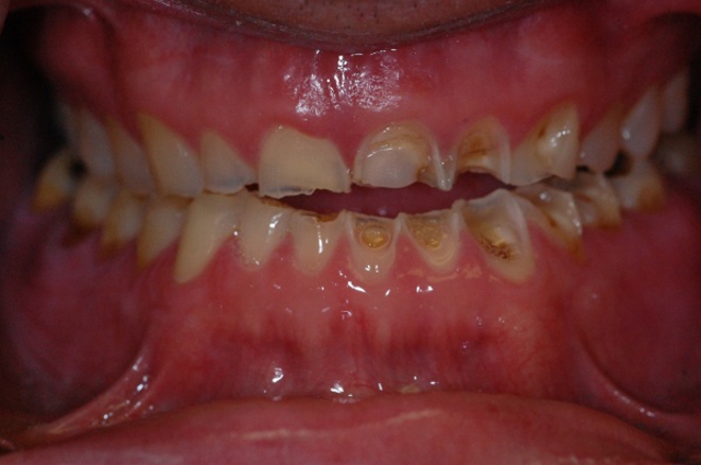 Photo of Doundoulakis James DMD, MS A Trained Specialist In Prosthodontics
