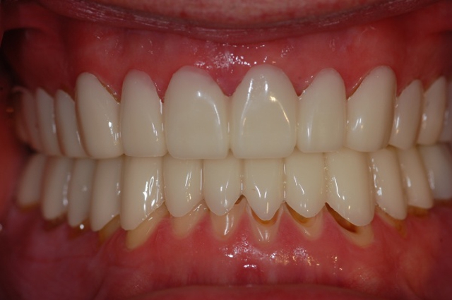 Photo of Doundoulakis James DMD, MS A Trained Specialist In Prosthodontics