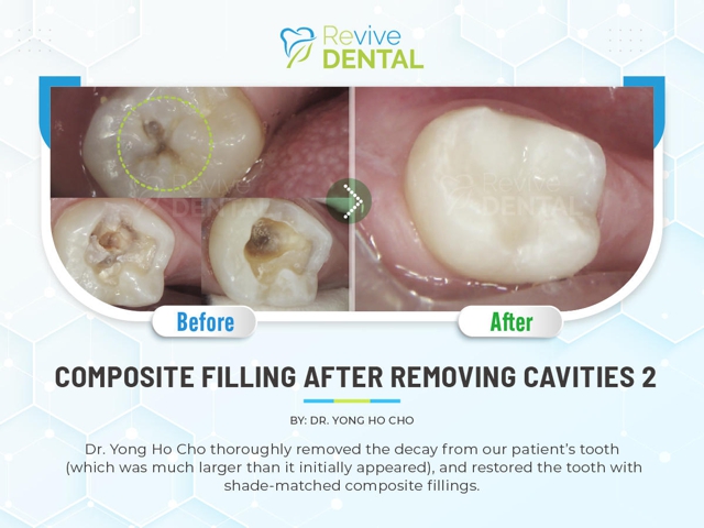 Photo of Revive Dental of Irving Family Cosmetic Emergency Implants