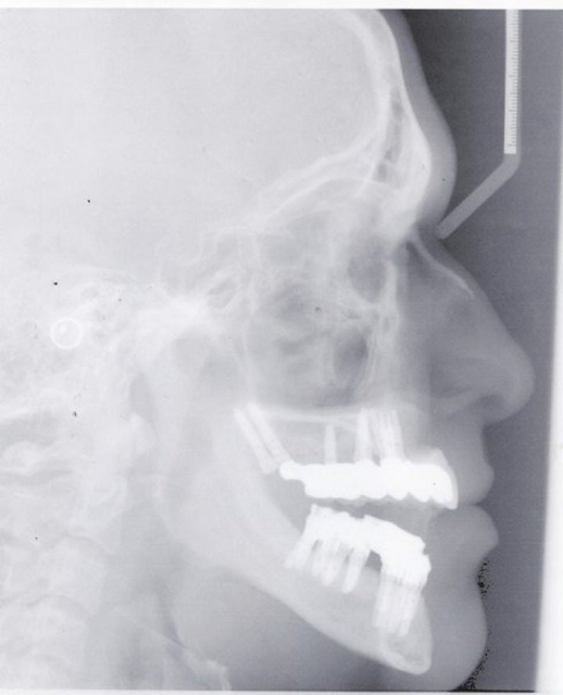 Photo of Pi Dental Center Providing Our Dental Patients