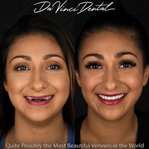 Photo of Da Vinci Dental Offering The Most Up-to-date Cosmetic Dental Techniques