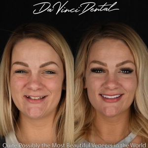 Photo of Da Vinci Dental Offering The Most Up-to-date Cosmetic Dental Techniques