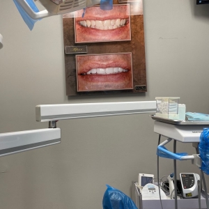 Photo of Teresa Bello - Burgos ,DMD, AAACD Full Mouth Reconstruction General Dentistry