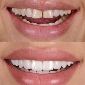 Rocklin Robert Soto, DDS Clinic