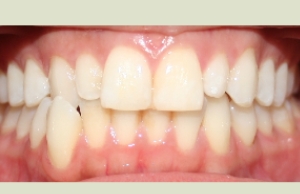 Photo of Camilo Riaño Orthodontics Top Rated Orthodontist In Beautiful San Francisco