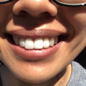 Photo of Silicon Valley Smile Solutions Leading Center For Dental Implants
