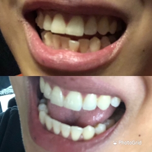 Photo of ConfiDental Smile