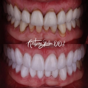 Photo of Antigone Skoulas, DDS Dental Procedures