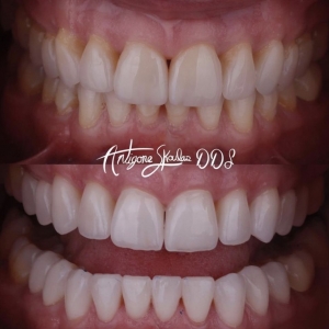 Photo of Antigone Skoulas, DDS Dental Procedures