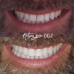 Photo of Antigone Skoulas, DDS Dental Procedures
