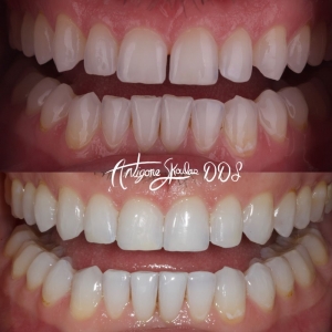 Photo of Antigone Skoulas, DDS Dental Procedures
