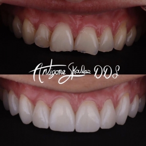 Photo of Antigone Skoulas, DDS Dental Procedures