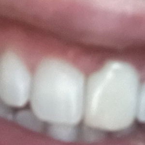 Photo of Dentistry of San Francisco - General & Cosmetic, Dr. Joseph DDS specializes in both General and Cosmetic Dentistry