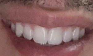Photo of Dentistry of San Francisco - General & Cosmetic, Dr. Joseph DDS specializes in both General and Cosmetic Dentistry