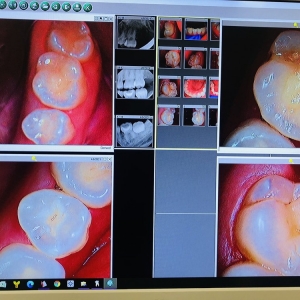 Photo of CitiDent Serve Your Every Dental Need