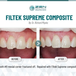 Photo of Zen Dental Center Family Cosmetic Emergency Implants