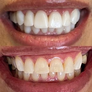 Photo of Leyli Shirvani, DDS - My Dentist San Francisco